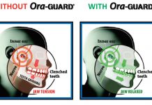New Nighttime Grind Guard Relieves Jaw Pain