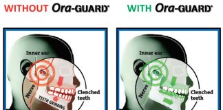 New Nighttime Grind Guard Relieves Jaw Pain