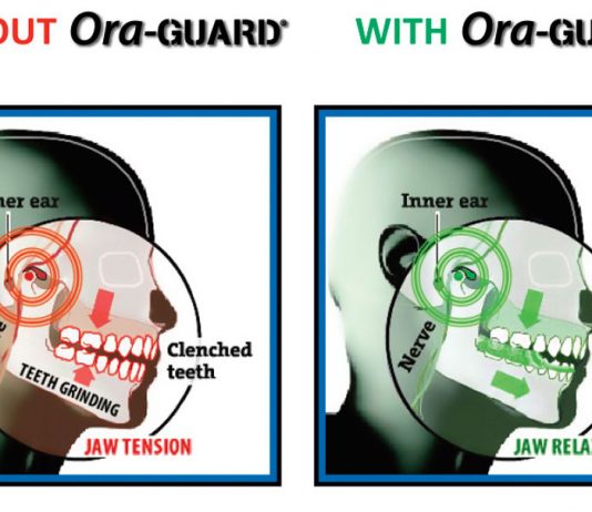 New Nighttime Grind Guard Relieves Jaw Pain